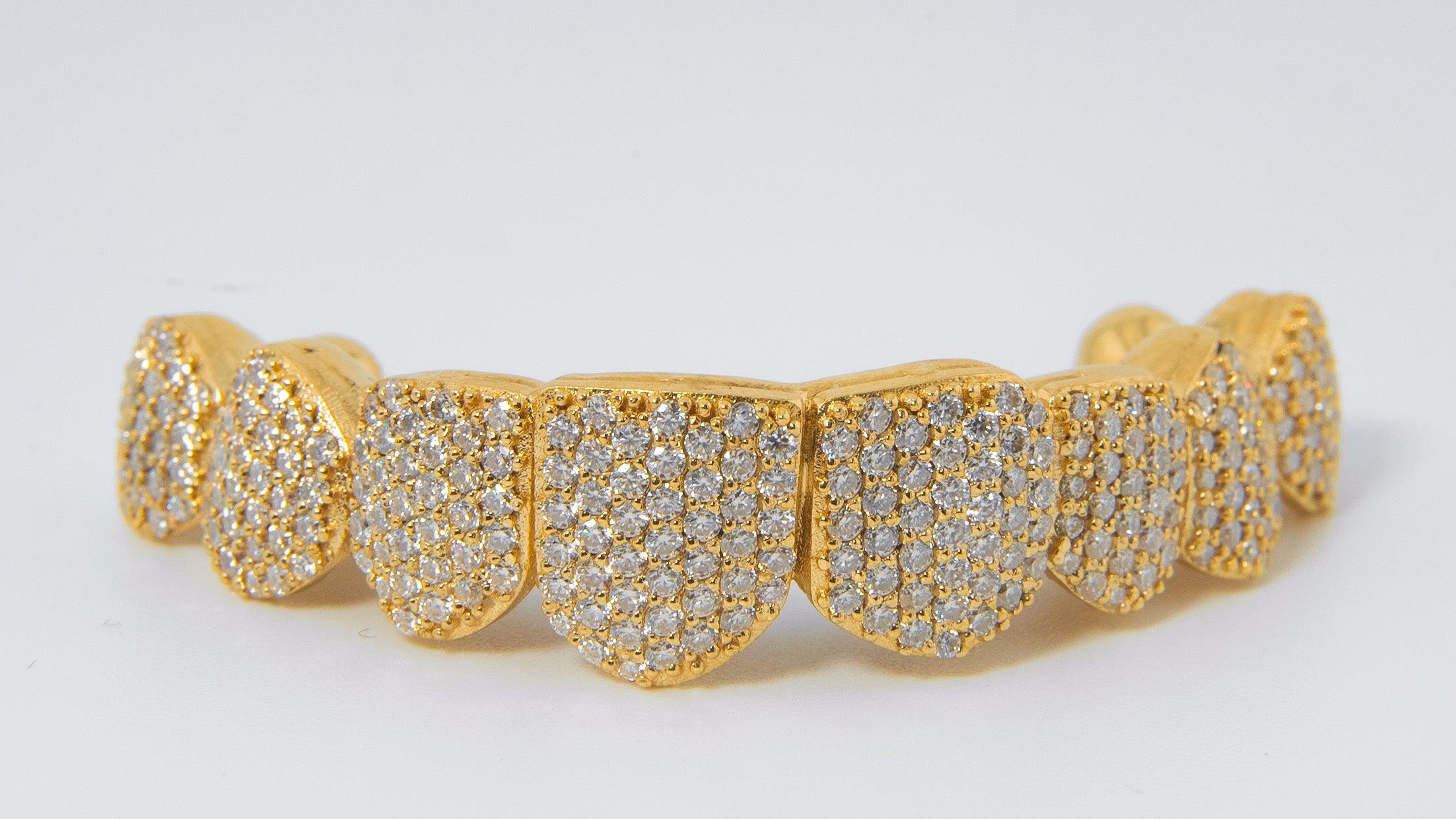 Top Diamond Grillz to Upgrade Your Smile in 2025