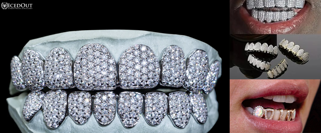 The Rise of Grillz: Why Everyone’s Talking About Diamond Teeth