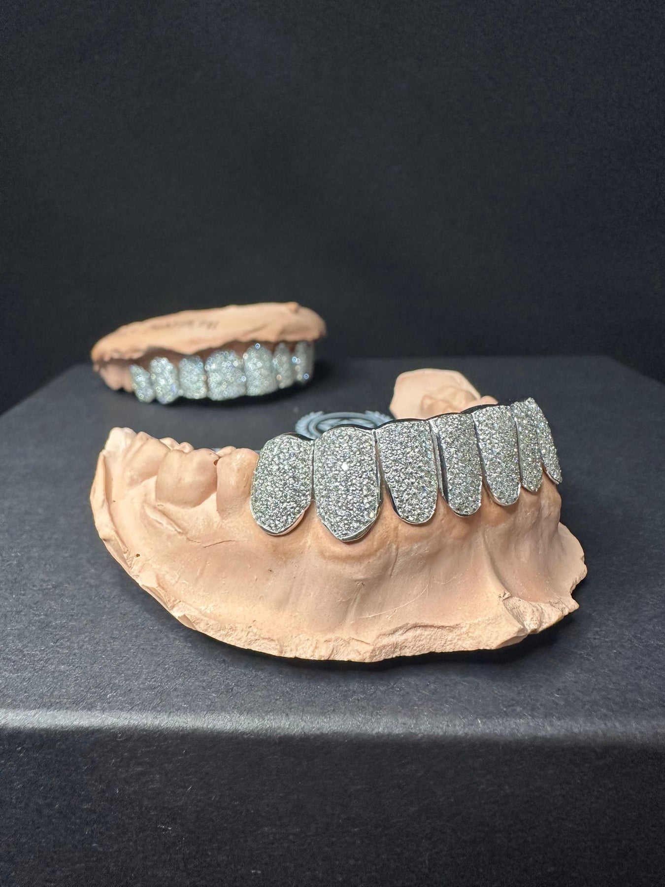 Vvs diamond sales gold teeth